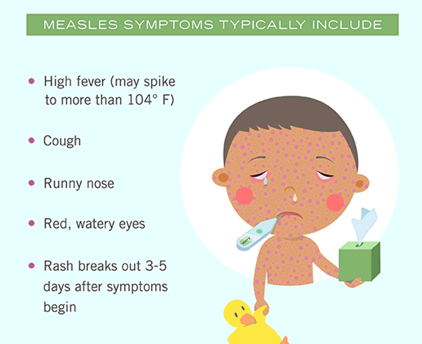 measles-infographic 2