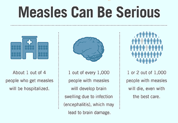 measles-infographic 3